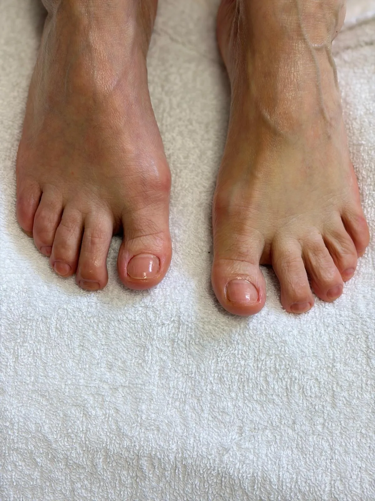 Dete Beauté gallery 4