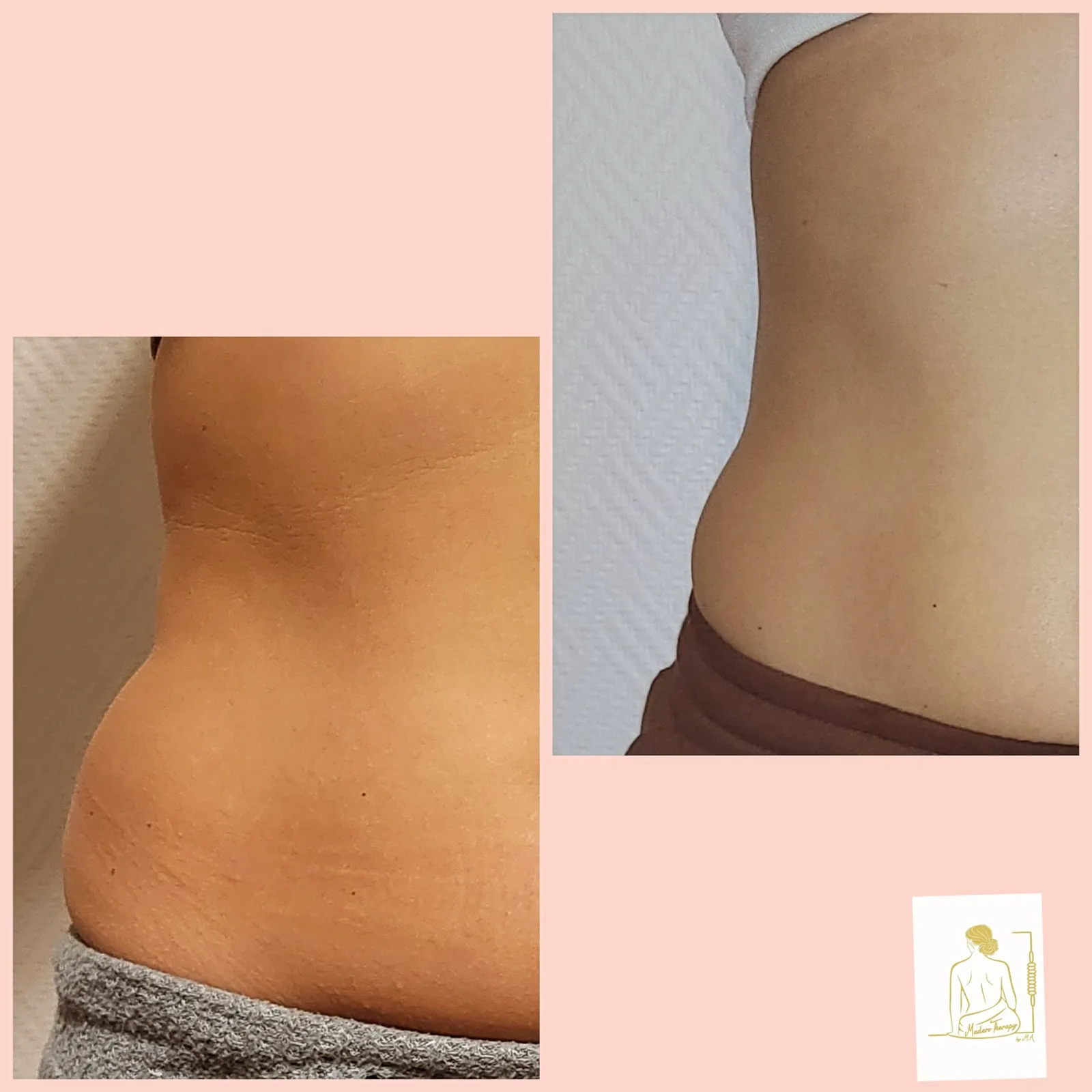 Maderotherapy by M.A gallery 2