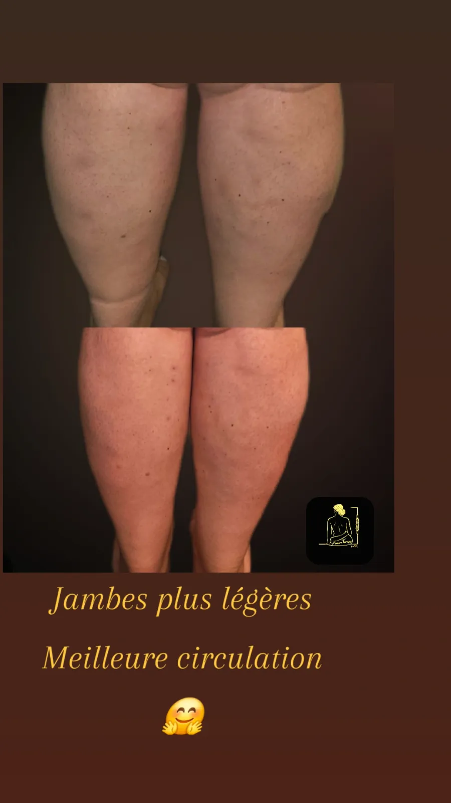 Maderotherapy by M.A gallery 4